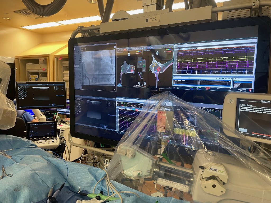 CIRCULATION UpーtoーDate 8ー2-現在と未来をになうCardiologistのための 外科手術困難な大動脈弁狭窄症 [大型本] The President Has Heart Surgery